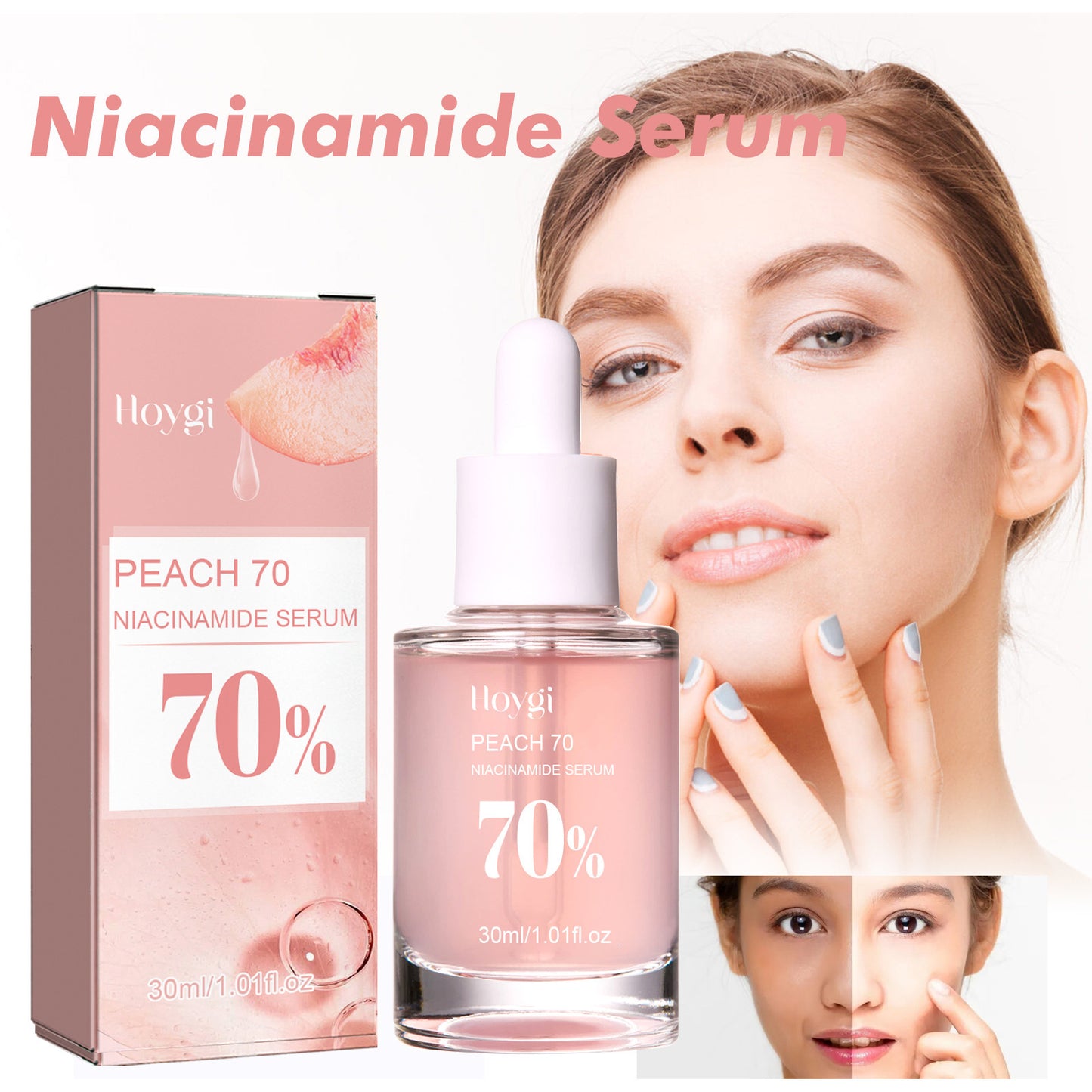 Hoygi Niacinamide Essence Moisturizing Pore Rejuvenating