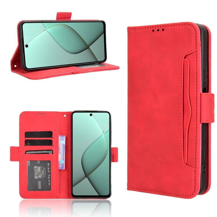 Skin Feel Calf Texture Card Slots Leather Phone Case, For Tecno Spark Go 1 / Pop 9 / Spark Go 2025, For Tecno Spark 30C 4G, For Tecno Spark 20 Pro 5G, For Tecno Camon 30 Premier 5G