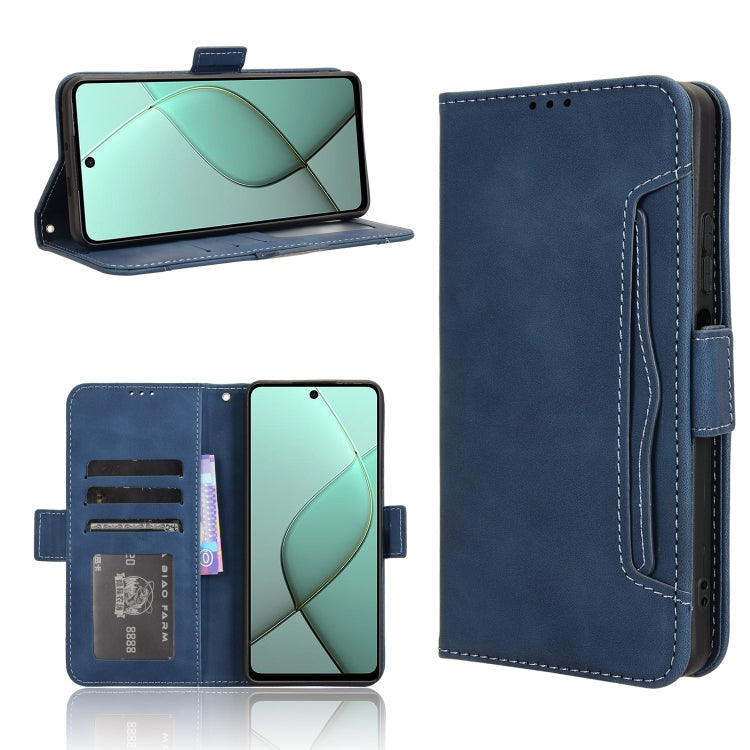 Skin Feel Calf Texture Card Slots Leather Phone Case, For Tecno Spark Go 1 / Pop 9 / Spark Go 2025, For Tecno Spark 30C 4G, For Tecno Spark 20 Pro 5G, For Tecno Camon 30 Premier 5G